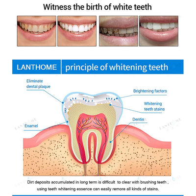 TeethWhip™ - Essence For Teeth Whitening (50% OFF) 