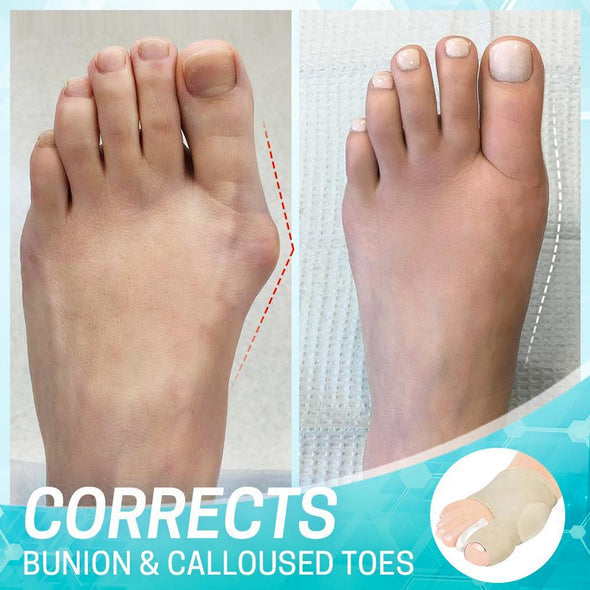 Dr.Healthy bunion correction sleeve