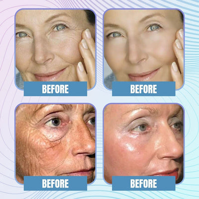 Youthful™️ Collagen Instant Boost Mask (5 pairs/10 pieces) 