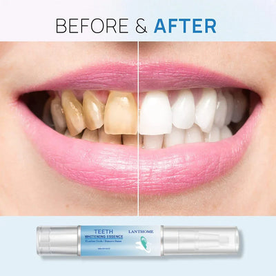 TeethWhip™ - Essence For Teeth Whitening (50% OFF) 