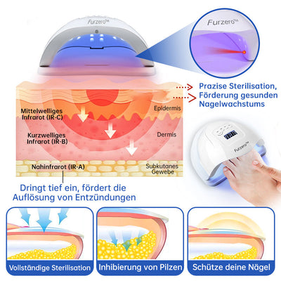 NailCure™ - Nail Fungus Laser Treatment Solution (50% OFF)