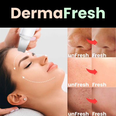 DermaFresh | Skin care without compromise (50% OFF) 