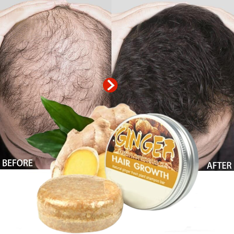 1+1 FREE | Ginger Hair Growth Shampoo Bar 