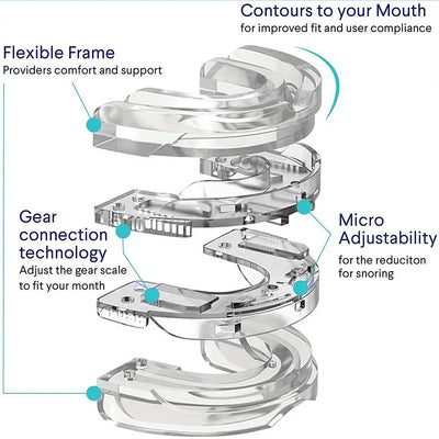 SnoreStop™ - Anti-Snoring Bruxism Mouthguard (50% OFF)