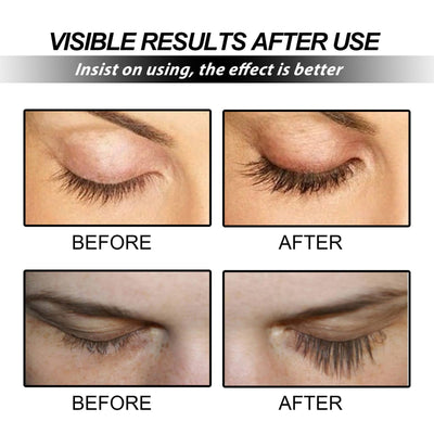 EELHOE™ - Professional Eyelash Serum (1+1 FREE)