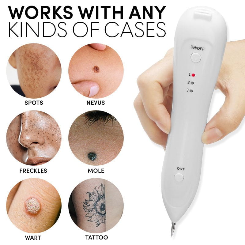 MoleOut™ - Spot-Free Electric Beauty Pen (50% OFF)